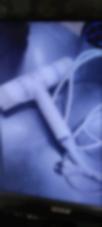 Ремонт фенов Vestel