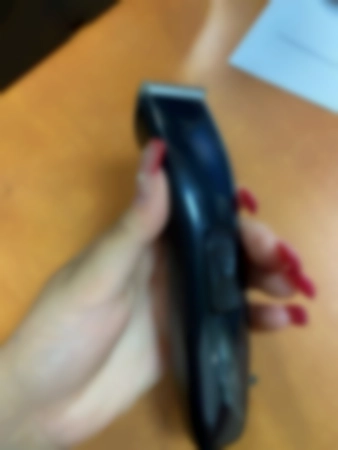 Ремонт электробритв Moser 1586